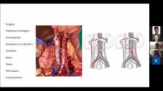 Testicular tumor case based discussion [upl. by Loos]