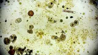 Mikrooganismen  microorganisms  Leben im Wassertropfen  microorganisms under microscope [upl. by Yewed]