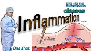 MSNwhat is InflammationMedical surgical nursingpathophysiology of inflammationsteps [upl. by Haliled]