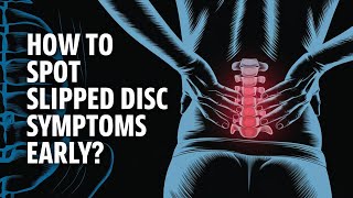 Slipped Disc Symptoms You Shouldn’t Ignore [upl. by Herwick697]