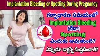 Implantation Bleeding amp Spotting అంటే ఏమిటి ఎలా గుర్తించాలి  Bleeding amp Spotting During Pregnancy [upl. by Belloir]