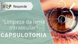 Capsulotomia quotlimpeza da lente intraocularquot [upl. by Meekah]