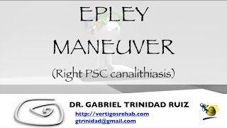 EPLEY MANEUVER RIGHT PSC [upl. by Powder]