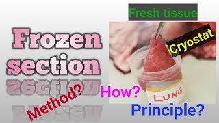 Frozen section in HistologyFrozen section biopsyFrozen section preparationSTAR LABORATORY [upl. by Alisia]