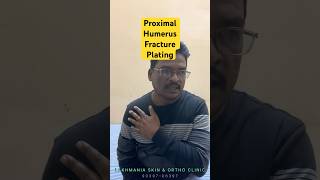 Patient testimonial humerus fracture plating reviews happypatient recovery fracturehealing [upl. by Ahsinek]