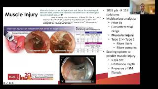 ISDE 2024  PostResection Strictures [upl. by Fari599]