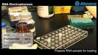 RNA Electrophoresis [upl. by Rihat282]