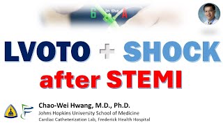 Cardiogenic Shock from LVOT obstruction postMI [upl. by Olegnalehcim]