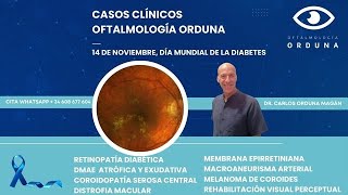 OFTALMOLOGÍA ORDUNA CASOS CLÍNICOS Y PERLAS [upl. by Ellebasi]