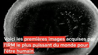 Première mondiale L’IRM le plus puissant au monde livre ses premières images [upl. by Ari]