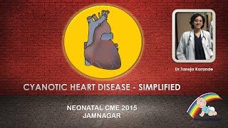 Cyanotic Heart Disease  Simplified By Dr Tanuja Karande [upl. by Jaime653]