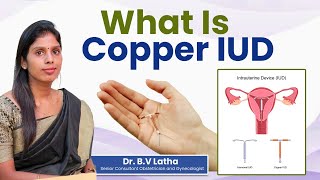 Copper IUDCopper IUD BasicsHow It WorksSide Effects amp Myths Busted DrBVLatha Ankura Hospital [upl. by Naenej708]