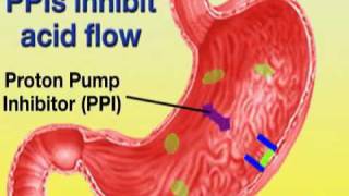 Esomeprazole Nexium [upl. by Kingsbury916]