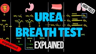 UREA BREATH TEST for Helicobacter Pylori Explained [upl. by Trace193]