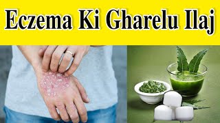 Eczema Ka Gharelu Ilaj  एक्जिमा का इलाज क्या है  Eczema Treatment In Ayurveda  Eczema Ki Dawa [upl. by Anahsor]