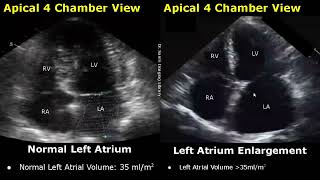 Echocardiography Normal Vs Abnormal Images  Heart Ultrasound  Cardiac ColorSpectral Doppler USG [upl. by Adnhoj]