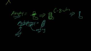 3  Introduction to Pathology  Atrophy Metaplasia [upl. by Nerrat827]