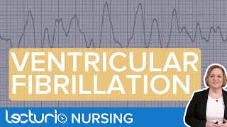 Ventricular Fibrillation ECG Interpretation amp Presentation [upl. by Nulubez]