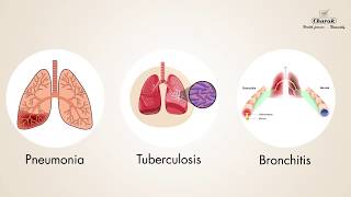 Chest Infections Symptoms and Treatment by Dr Mahashur [upl. by Llenrad]