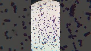 Micrococcus in urine culture culture microbiology bacteria gramstaining [upl. by Andi]