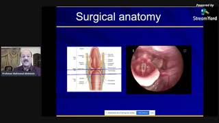 Cancer Larynx ProfMahmoud Abdelaziz [upl. by Orola]