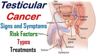 Testicular Cancer  Signs Symptoms Risk Factors Types and Treatments  Cancer Knowledge [upl. by Aidnac68]