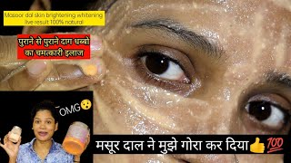 Masoor dal whitening brightening face pack  Masoor dal skin whitening face scrub 100 natural👍 [upl. by Kerr]