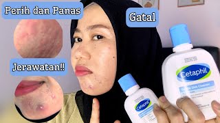 REVIEW CETAPHIL GENTLE SKIN CLEANSER 3 BULAN PAKAI  BREAKOUT DONG [upl. by Harpole532]