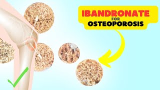 Ibandronate Sodium Supporting Bone Health and Osteoporosis Prevention [upl. by Bannerman]