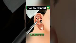 Ear infection treatment calmdown musica youtubeshorts trending [upl. by Rihat]