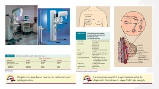 Mamografía p2 Tipos de mamografía Anatomía de la mama Sistema de imágenes mamográfico [upl. by Yromas]