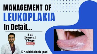 MANAGEMENT OF LEUKOPLAKIA IN DETAIL [upl. by Israeli]