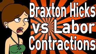 Braxton Hicks vs Labor Contractions [upl. by Mateo524]