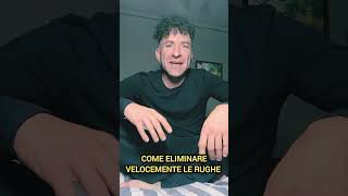 Rughe Come Eliminarle Velocemente  caloironix [upl. by Holms]