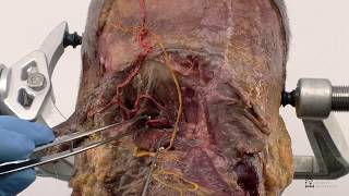 Anatomy Series  Posterior Craniocervical Junction [upl. by Daenis660]