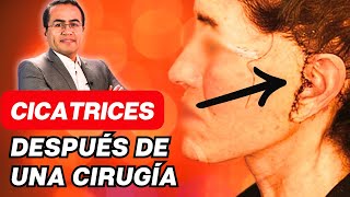 CICATRICEZ de una Cirugía Plástica 🙈 Abordaje Tratamientos complicaciones ✅ Dr Percy Nevado [upl. by Kezer]