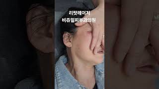 리팟 부작용 홍반 붉음증 리팟 레이저 비쥬얼피부과 세종리팟 세종시리팟 reepot lentigo 청주리팟 공주리팟 대전리팟 오창리팟 오송리팟 부여리팟 [upl. by Khoury]