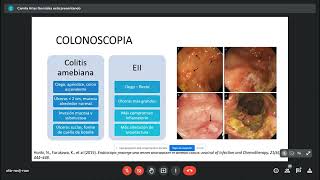 Seminario Colitis amebiana [upl. by Rolyak832]