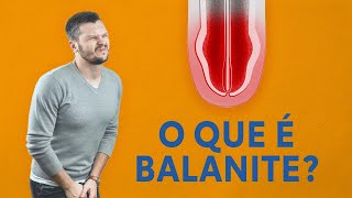 O que é balanite [upl. by Dasya]