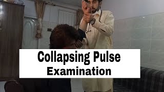 Collapsing Pulse Clinical ExaminationCausesPathologyvascular [upl. by Nhguavad]