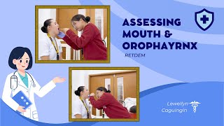 Assessment of Mouth amp Oropharynx [upl. by Luciana]