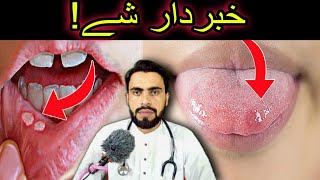 Mouth Ulcers or Canker Sore and Mouth Cancer Awareness in Pashto by Dr Mustaqeem [upl. by Davie]