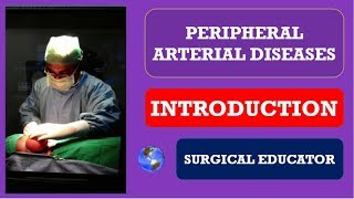 PERIPHERAL ARTERIAL DISEASES  INTRODUCTION Limb Ischemia [upl. by Aretahs]