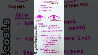 Thyrotoxicosis  Graves disease  Heat intolerance [upl. by Yruama317]