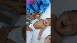 Baby cleft lip injections before Surgery [upl. by Yrallam]