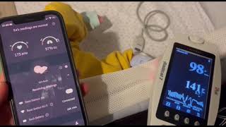 Owlet Smart Sock 3 vs medical grade device [upl. by Henricks209]