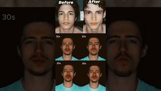 How to Get a Defined Jawline Without Mewing or Exercises [upl. by Eliades903]