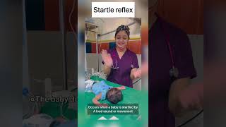 Startle reflex in newborn  moro’s reflex  baby doctor newborn babyvideos shorts cutebaby [upl. by Mairhpe]