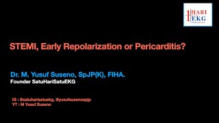 STEMI NSTEMI or Early Repolarization Pattern De Winter Sign Hyperacute T 4 Variable Formula [upl. by Mccreery]