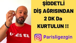 Şiddetli Diş Ağrısı Nasıl Geçer  2 dakika da Diş Ağrısına Kesin Çözüm [upl. by Aizirtap]